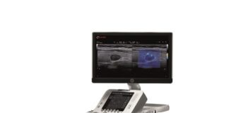 УЗИ аппараты от компании «Глобал Медикал Трейд»: ваш надежный партнер в мире диагностических исследований