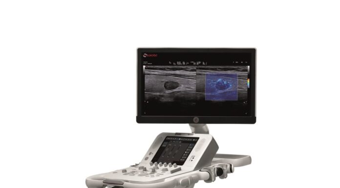 УЗИ аппараты от компании «Глобал Медикал Трейд»: ваш надежный партнер в мире диагностических исследований